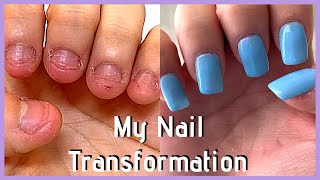 UPDATE My FAST Nail Transformation in 2020 nail journey part 5 [upl. by Phillip]