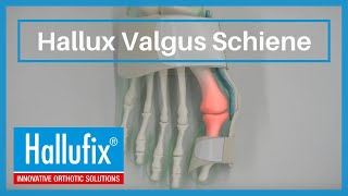 Hallufix® Hallux Valgus Schiene [upl. by Remington]