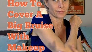 How To Cover A Big Bruise With Makeup [upl. by Tyler]