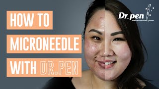 How to microneedle at home with Dr Pen  Dr Pen Australia  Microneedling  Skin Needling  CIT [upl. by Nanni928]