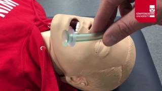 Nasopharyngeal Airway Insertion [upl. by Onimixam]