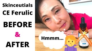 SkinceuticalsCE Ferulic Worth it Before and After [upl. by Vivi]