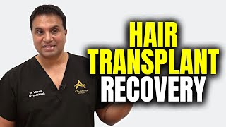 What To Expect After A Hair Transplant [upl. by Loutitia]