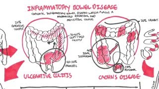 Humira Dosage Instructions [upl. by Ettolrahs732]