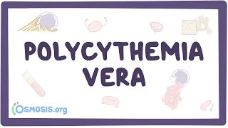 Polycythemia vera  causes symptoms diagnosis treatment pathology [upl. by Ennovyhs]