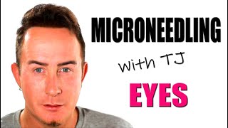 Microneedling the Eyes Tutorial  Treatment Chooser [upl. by Aunson799]