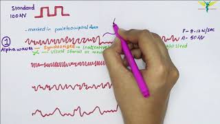 Cadwell Easy Ambulatory EEG Part 3 [upl. by Kitrak]