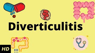 Top 6 Foods To Avoid With Diverticulitis [upl. by Valeda]