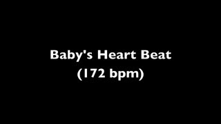 Fetal Heart Beat Audio 11 Weeks Pregnant [upl. by Wilder]