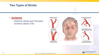 How Endovascular Stroke Treatment Works [upl. by Leonore]