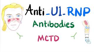 AntiU1Ribonucleoprotein AntiU1RNP autoantibodies [upl. by Tennaj]