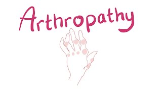 Arthropathy  Joint Pathology Classification [upl. by Eckhardt]