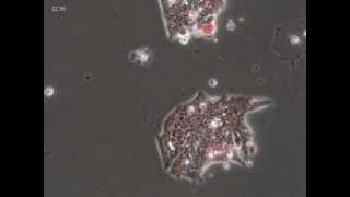 Epithelial to Mesenchymal Transition [upl. by Tsnre]