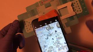 Using the foldscope to collect parasite egg images a demo [upl. by Song]