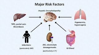 Hepatic Encephalopathy [upl. by Rahel]