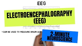 MY 48HR EEG BRAIN SCAN EXPERIENCE [upl. by Breena]