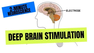 Isochronic tone stimulation Pineal Gland 30min [upl. by Eiuqnom]