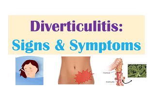 Diverticulitis Risk Factors ex Low Fiber Diets Symptoms Diagnosis Treatment and Complications [upl. by Sucramrej]