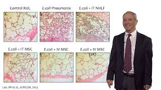 Fibronectin Stress fibers role in Mesenchymal Stem Cells differentiation [upl. by Ymerej]