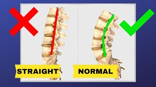 Chiropractic NO TWIST Low Back Hip Adjustment prochiropractic [upl. by Yro]