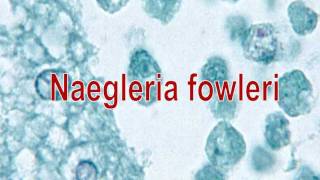 Naegleria fowleri [upl. by Kensell305]