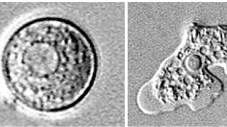 How to stay safe from the braineating amoeba [upl. by Leaper]