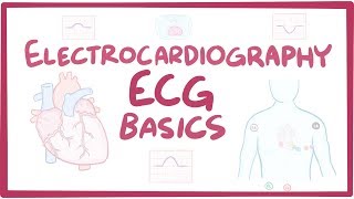 Therapeutic Modalities Electrical Stimulation [upl. by Panchito936]