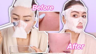 DIY Egg Peel Off Mask  YesHipolito [upl. by Eneryt]