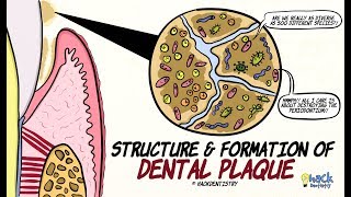 Dental Plaque Structure and Formation [upl. by Marget]