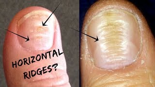 8 ALARMING Things Your Nails Is Warning You About Your HEALTH ⚠️💅 [upl. by Goodwin]